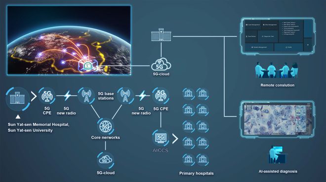 智能診斷新紀(jì)元 AI宮頸癌篩查系統(tǒng)為病理醫(yī)師賦能